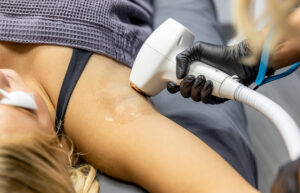 Copy of New Med Spa - Hair Removal -2051